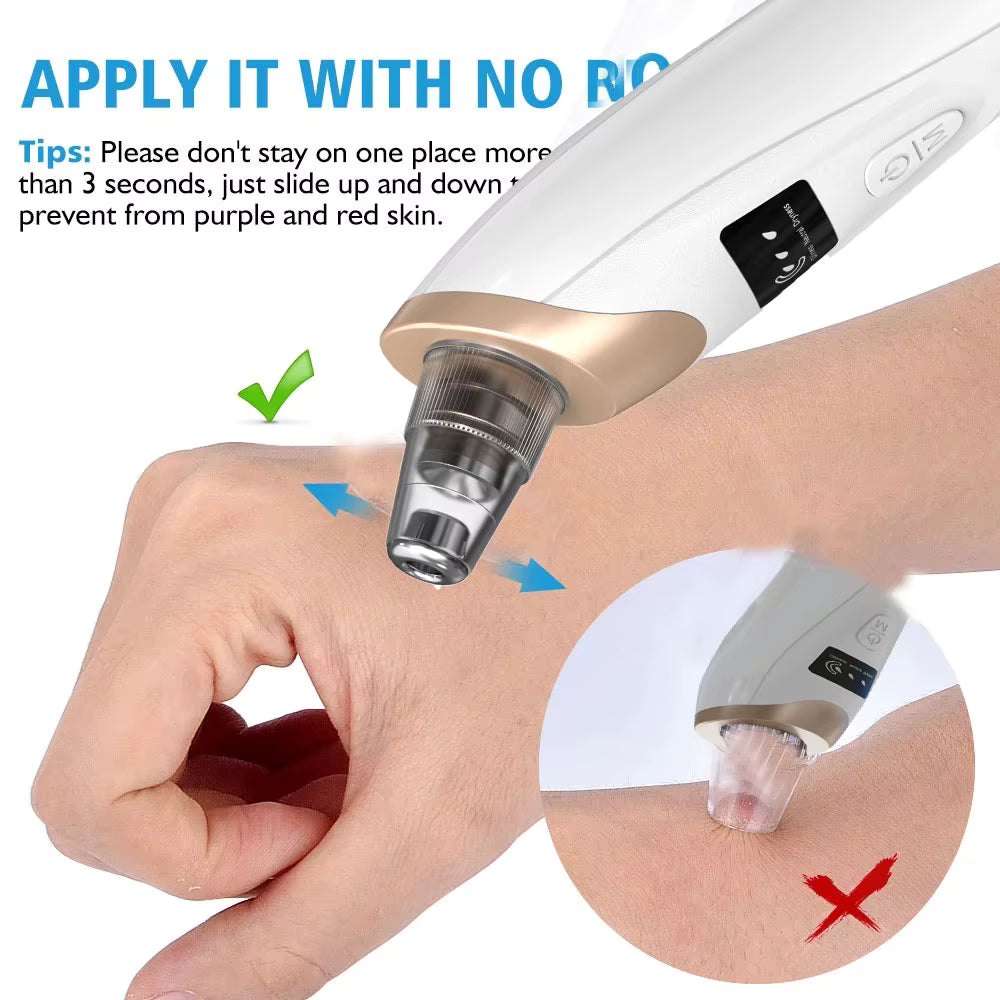 Blackhead Remover Pore Vacuum