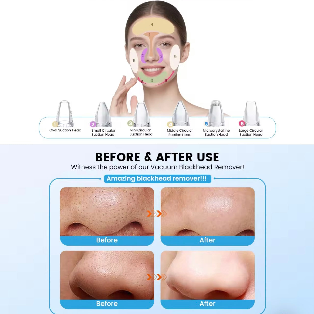 Multi-Functional Blackhead Remover & Pore Cleaner
