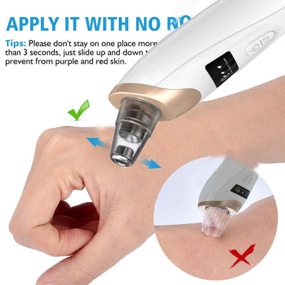 Blackhead Remover Pore Vacuum