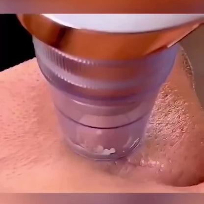 Multi-Functional Blackhead Remover & Pore Cleaner